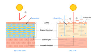 30616598 dry and healthy skin layer illustration beauty and skin care concept 1