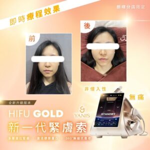 HIFU GOLD 新一代緊膚索