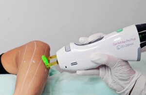 Candela GentleMax Pro Plus Alexandrit YAG Laser