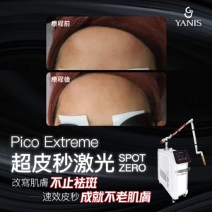 Pico Extreme 面 效果 01 1024x1024 1